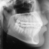 Radiologia Odontológica em Maceió